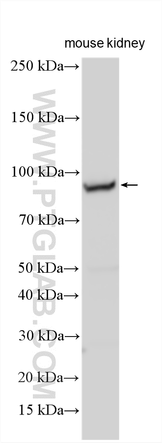 Western Blot (WB) analysis of various lysates using ACAD11 Polyclonal antibody (16997-1-AP)