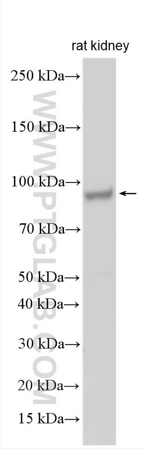 Western Blot (WB) analysis of various lysates using ACAD11 Polyclonal antibody (16997-1-AP)