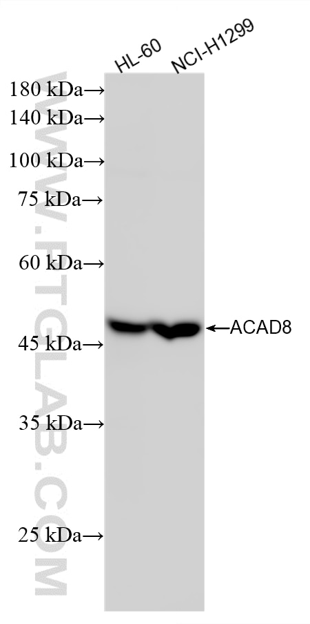 Western Blot (WB) analysis of various lysates using ACAD8 Recombinant monoclonal antibody (86742-2-RR)