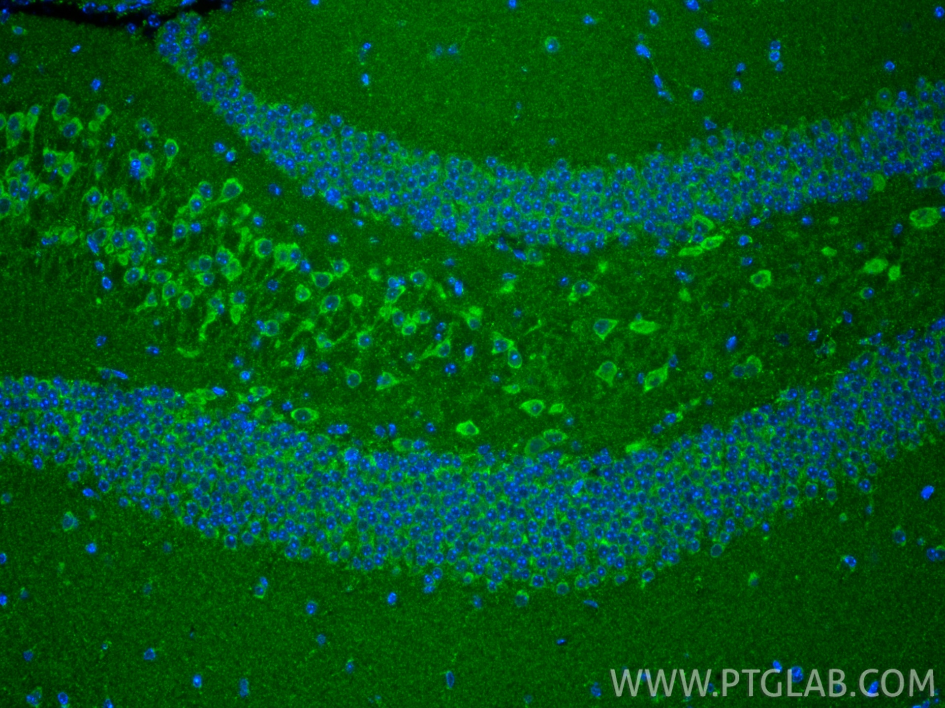 Immunofluorescence (IF) / fluorescent staining of mouse brain tissue using ACAD9 Polyclonal antibody (15770-1-AP)