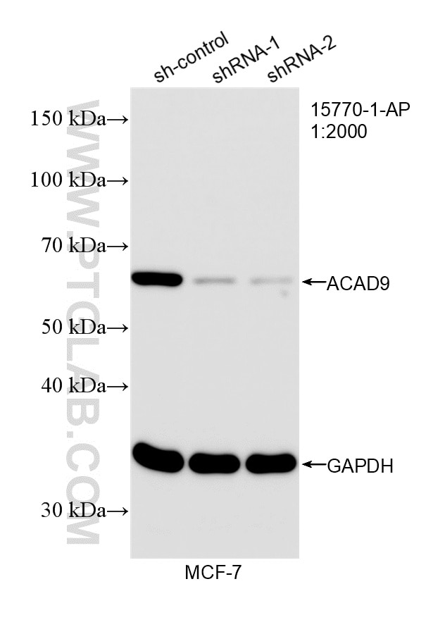 Western Blot (WB) analysis of MCF-7 cells using ACAD9 Polyclonal antibody (15770-1-AP)
