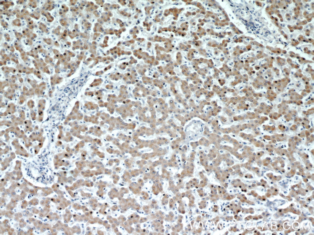 IHC staining of human liver using 17442-1-AP