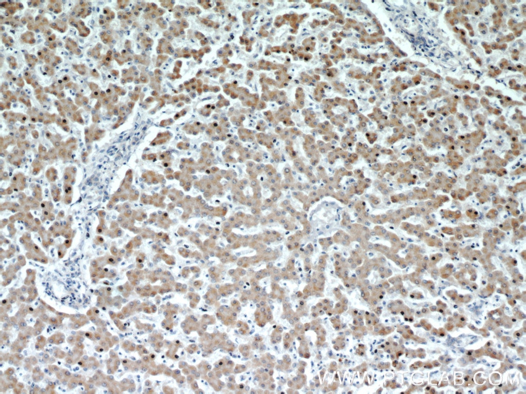 Immunohistochemistry (IHC) staining of human liver tissue using ACADL Polyclonal antibody (17442-1-AP)