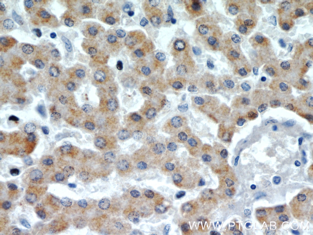 Immunohistochemistry (IHC) staining of human liver tissue using ACADL Polyclonal antibody (17442-1-AP)