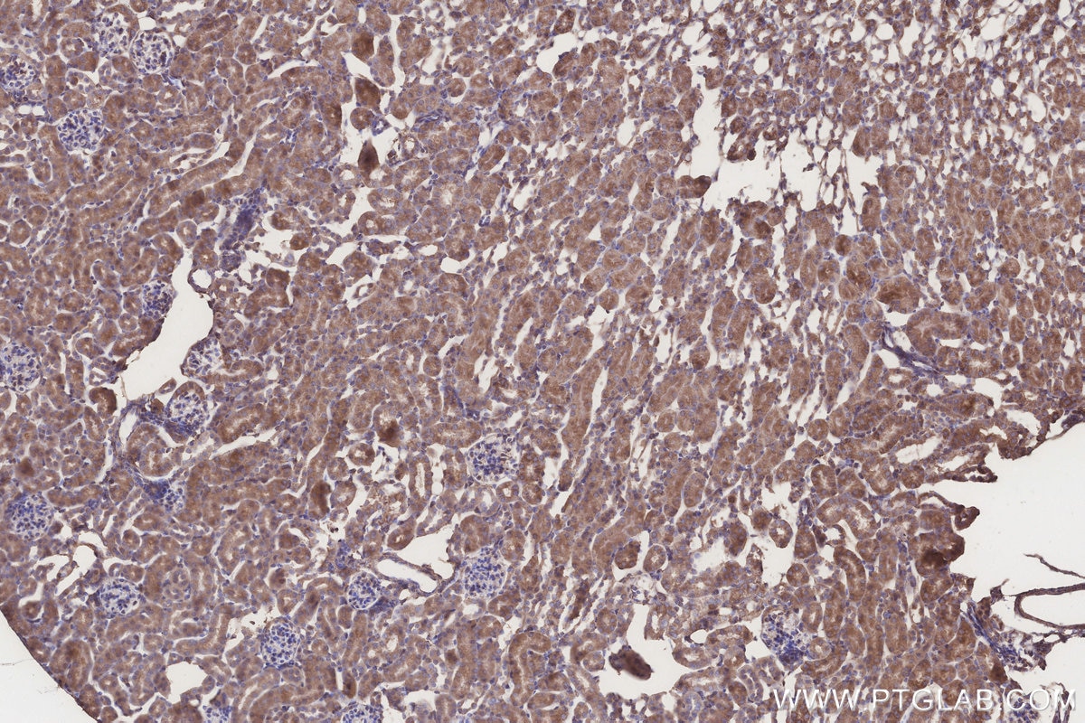 Immunohistochemistry (IHC) staining of mouse kidney tissue using ACADL Polyclonal antibody (17442-1-AP)