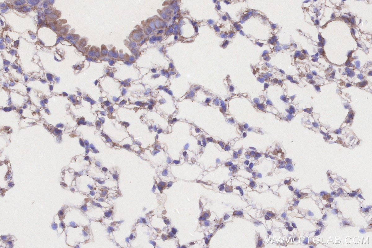 Immunohistochemistry (IHC) staining of mouse lung tissue using ACADL Polyclonal antibody (17442-1-AP)