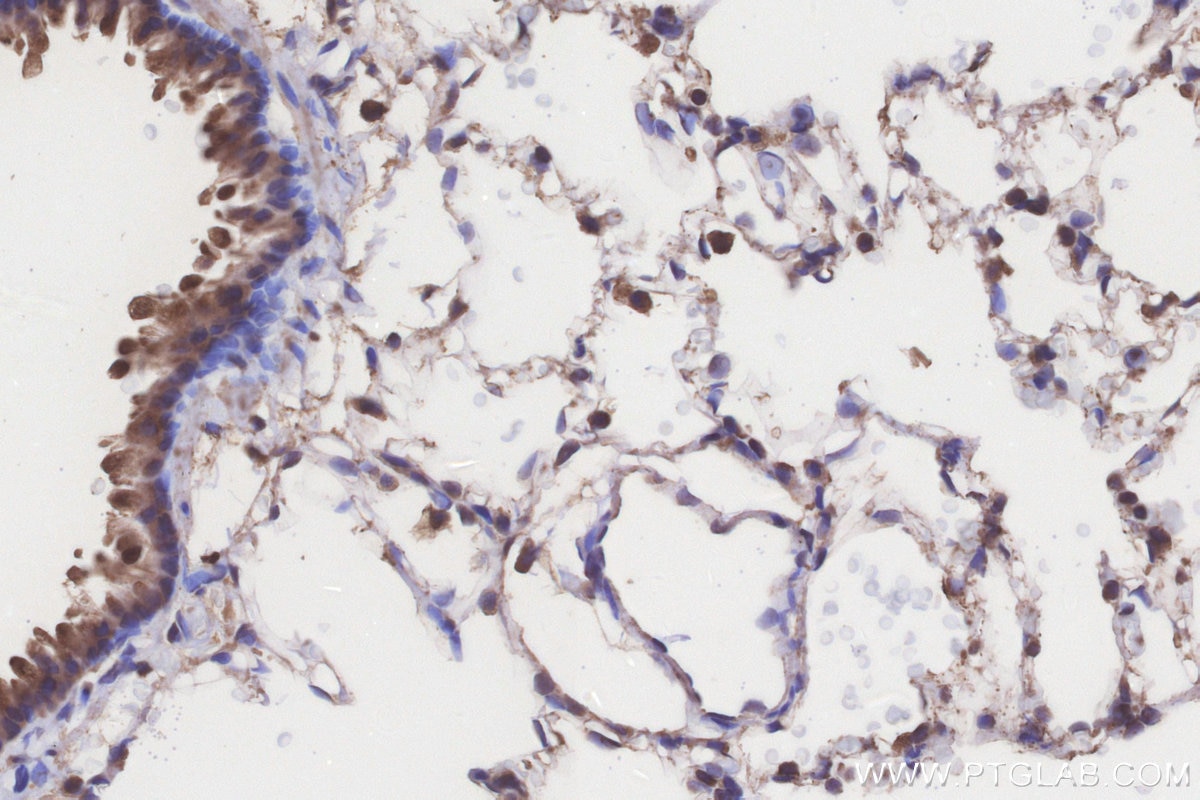 Immunohistochemistry (IHC) staining of rat lung tissue using ACADL Polyclonal antibody (17442-1-AP)
