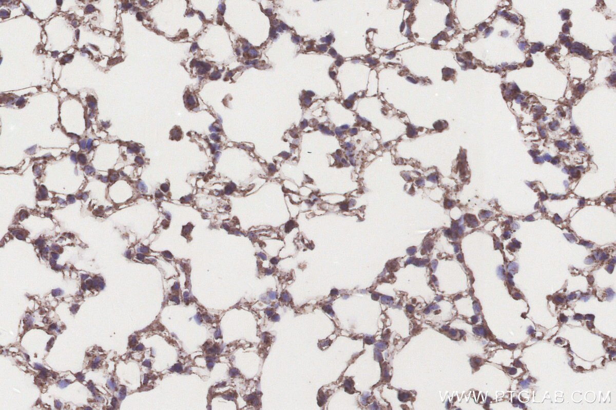 Immunohistochemistry (IHC) staining of mouse lung tissue using ACADL Polyclonal antibody (17442-1-AP)