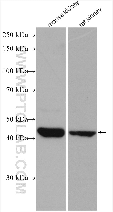 Western Blot (WB) analysis of various lysates using ACADL Polyclonal antibody (17442-1-AP)