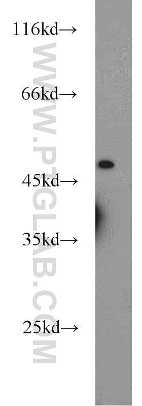 Western Blot (WB) analysis of HEK-293 cells using ACADL Polyclonal antibody (17442-1-AP)