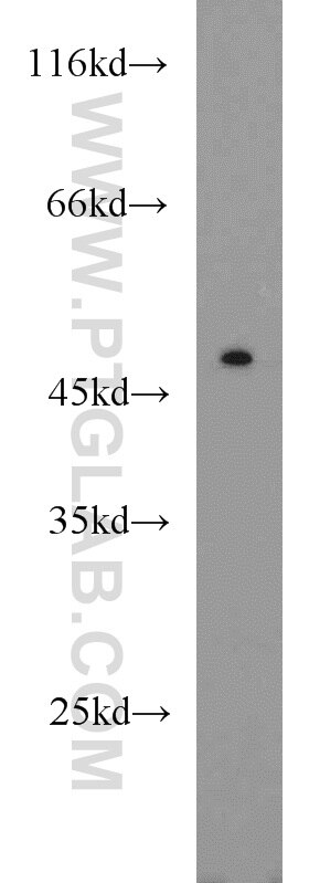 Western Blot (WB) analysis of HEK-293 cells using ACADL Polyclonal antibody (17442-1-AP)