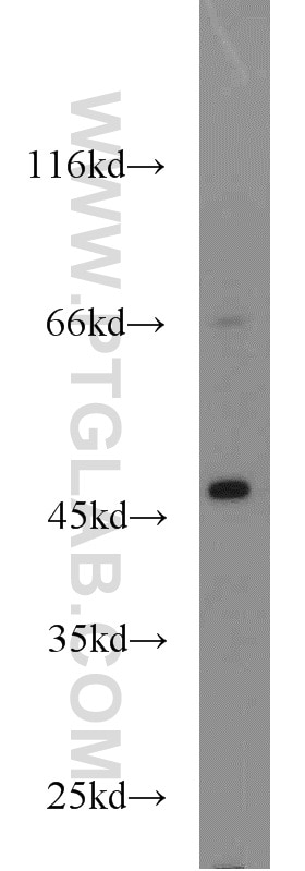 Western Blot (WB) analysis of HeLa cells using ACADL Polyclonal antibody (17442-1-AP)