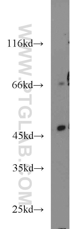 Western Blot (WB) analysis of HeLa cells using ACADL Polyclonal antibody (17442-1-AP)