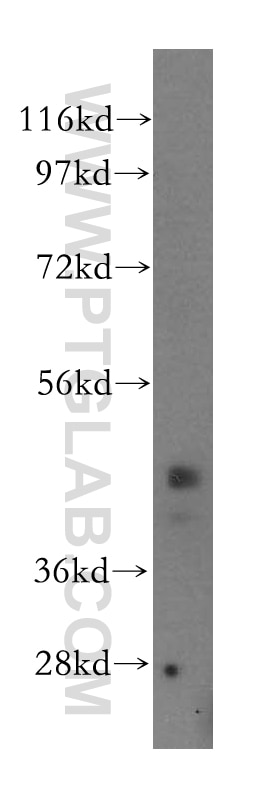 WB analysis of HeLa using 17442-1-AP