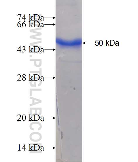 ACADL fusion protein Ag11330 SDS-PAGE