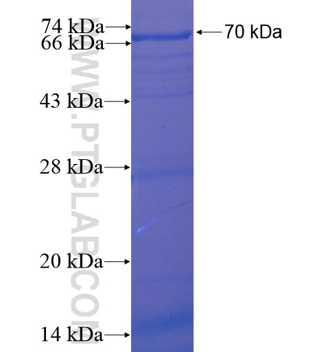 ACADL fusion protein Ag11530 SDS-PAGE