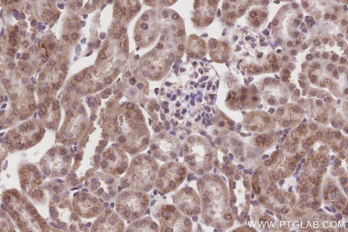 Immunohistochemistry (IHC) staining of mouse kidney tissue using ACADL-Specific Polyclonal antibody (17526-1-AP)