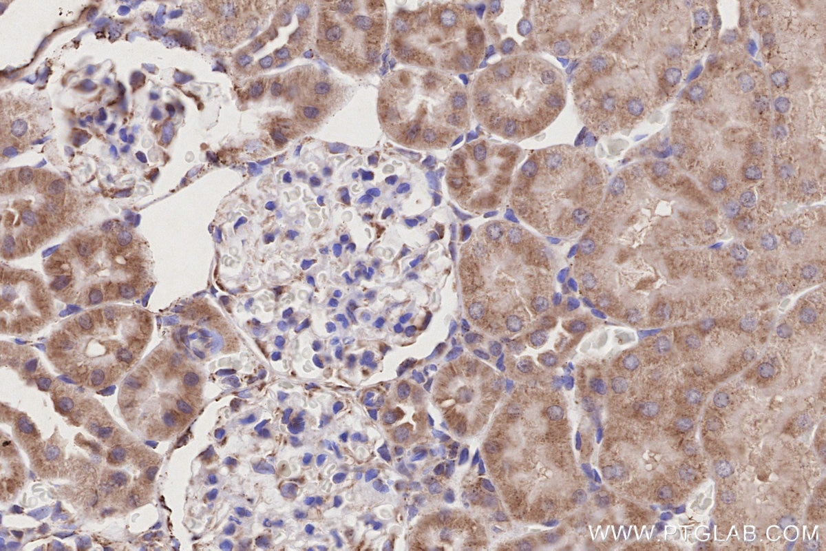 Immunohistochemistry (IHC) staining of rat kidney tissue using ACADL-Specific Polyclonal antibody (17526-1-AP)