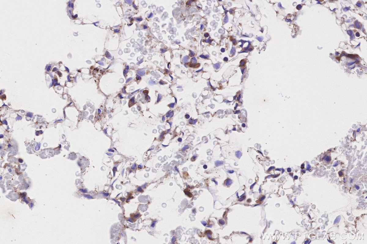 Immunohistochemistry (IHC) staining of rat lung tissue using ACADL-Specific Polyclonal antibody (17526-1-AP)