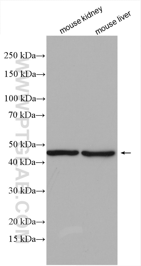 Western Blot (WB) analysis of various lysates using ACADL-Specific Polyclonal antibody (17526-1-AP)