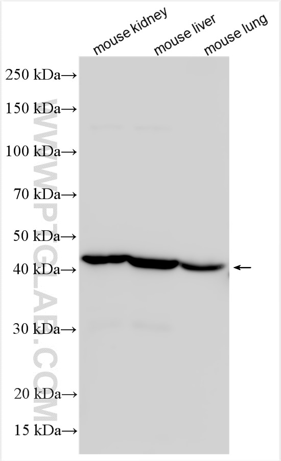 Western Blot (WB) analysis of various lysates using ACADL-Specific Polyclonal antibody (17526-1-AP)