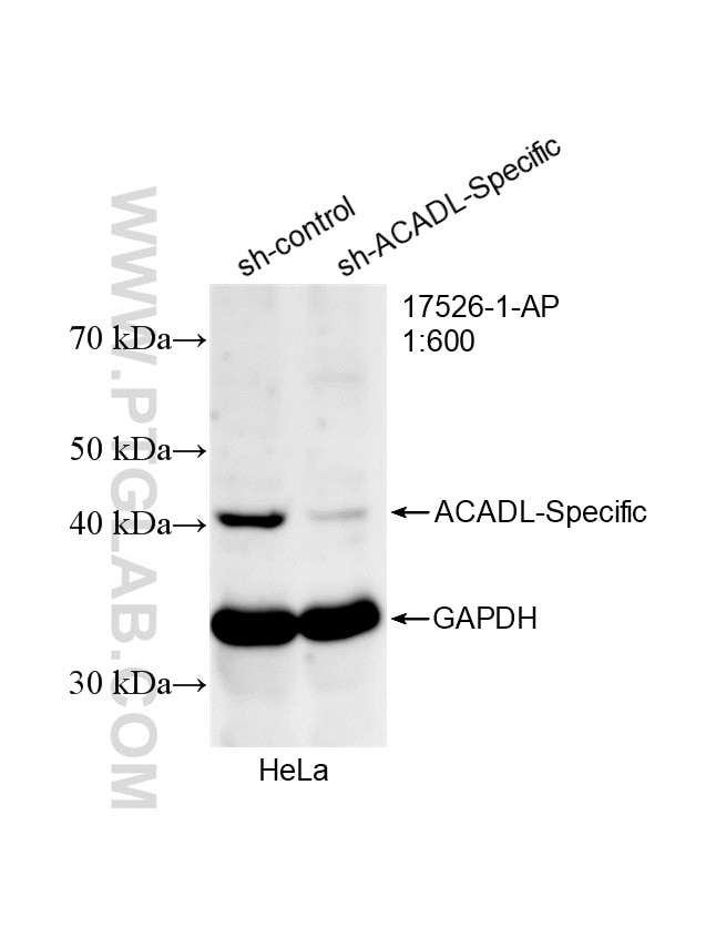 Western Blot (WB) analysis of HeLa cells using ACADL-Specific Polyclonal antibody (17526-1-AP)