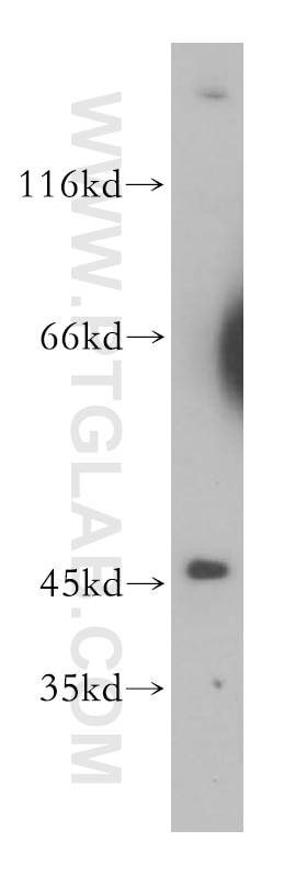 Western Blot (WB) analysis of mouse heart tissue using ACADL-Specific Polyclonal antibody (17526-1-AP)