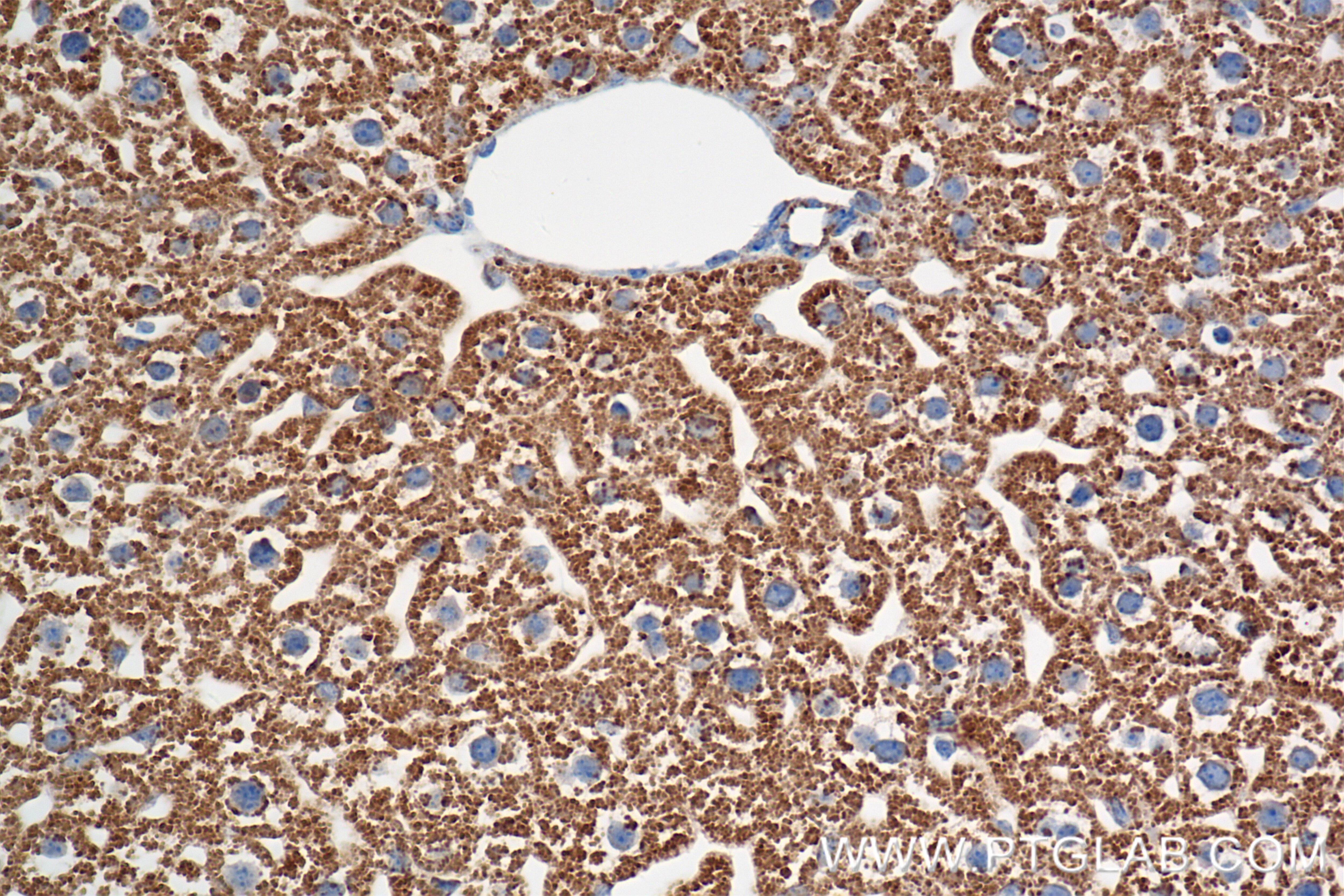 Immunohistochemistry (IHC) staining of mouse liver tissue using ACADL-Specific Recombinant antibody (85379-1-RR)