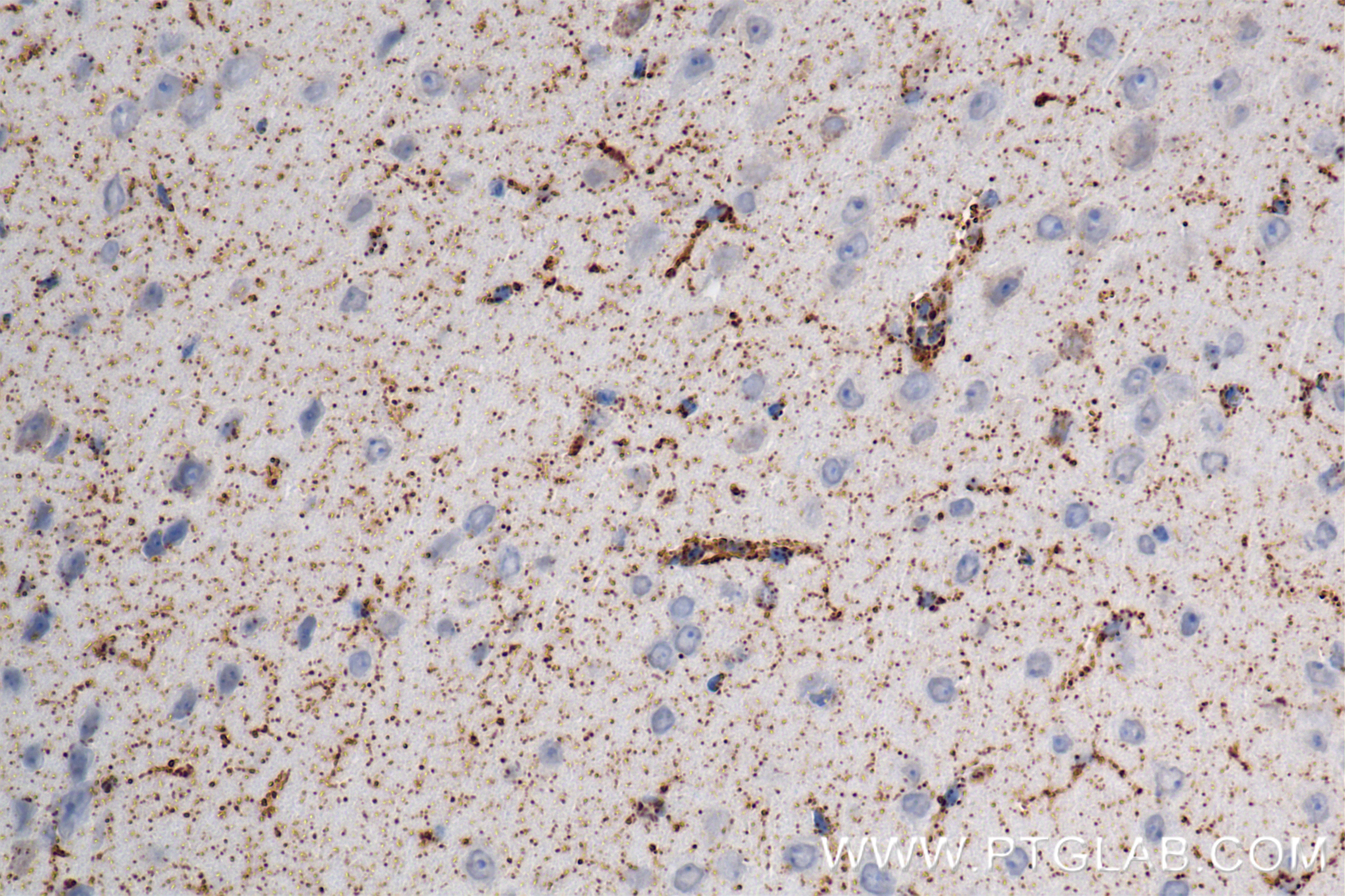 Immunohistochemistry (IHC) staining of mouse brain tissue using ACADL-Specific Recombinant antibody (85379-1-RR)