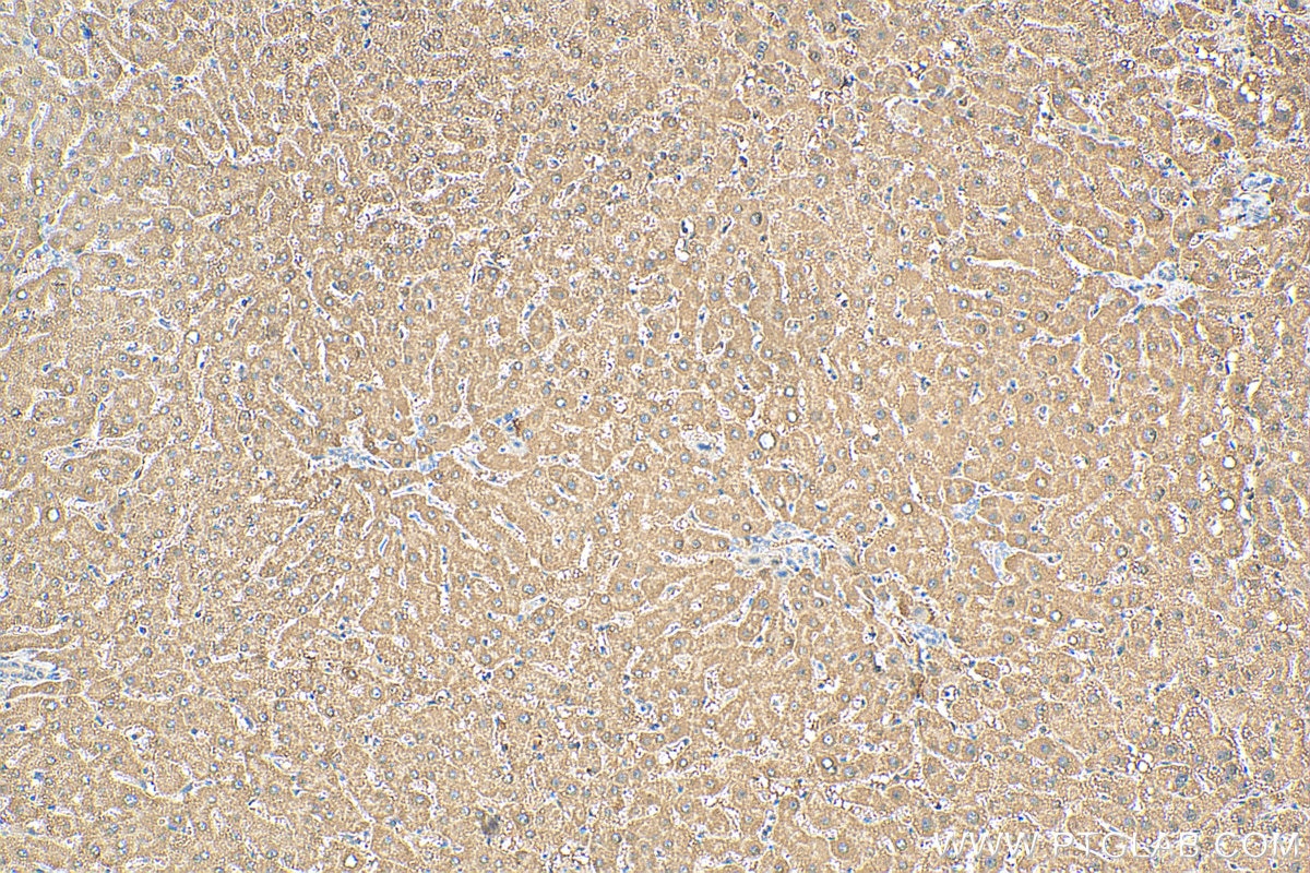 Immunohistochemistry (IHC) staining of human liver tissue using ACADM Polyclonal antibody (55210-1-AP)