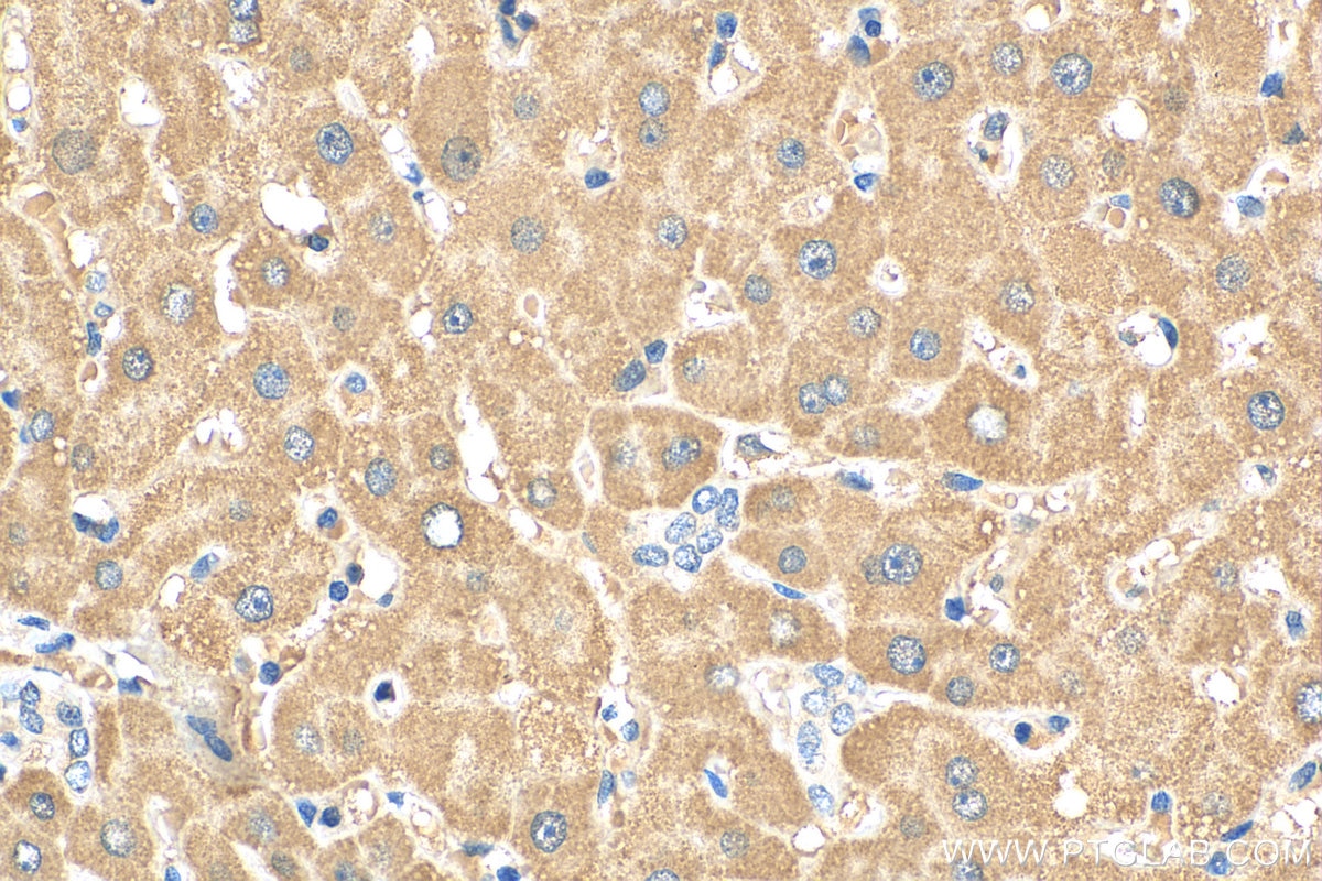 Immunohistochemistry (IHC) staining of human liver tissue using ACADM Polyclonal antibody (55210-1-AP)