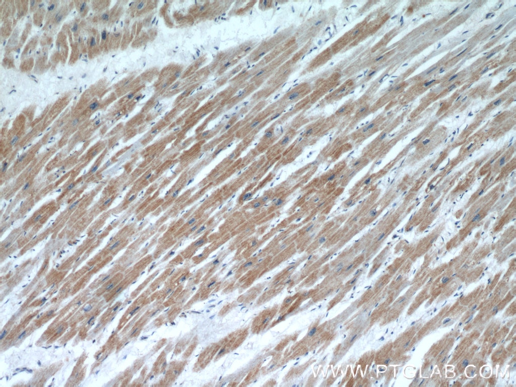 IHC staining of human heart using 55210-1-AP