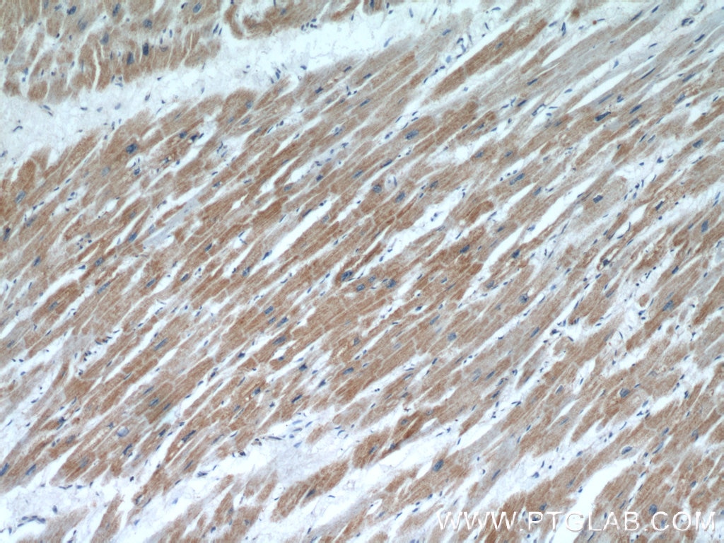 Immunohistochemistry (IHC) staining of human heart tissue using ACADM Polyclonal antibody (55210-1-AP)