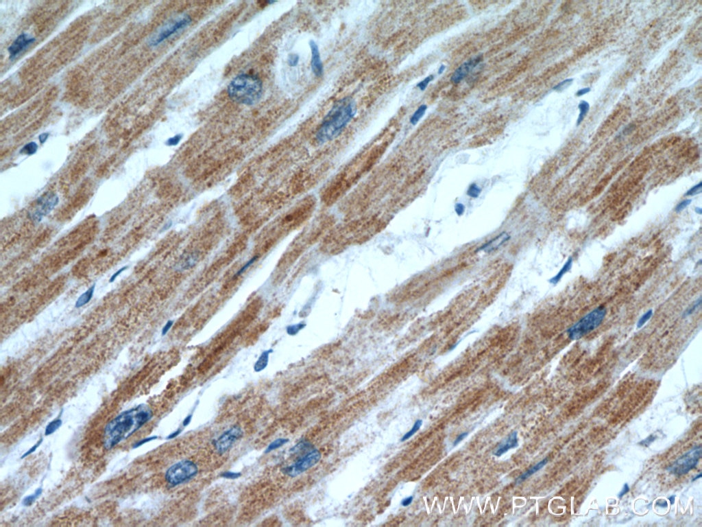 IHC staining of human heart using 55210-1-AP