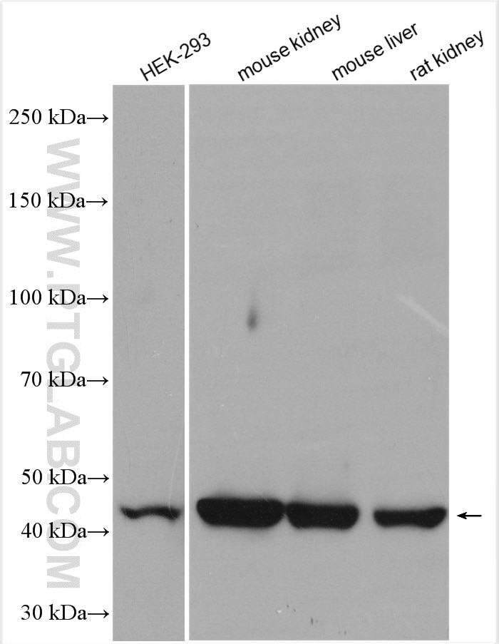 Western Blot (WB) analysis of various lysates using ACADM Polyclonal antibody (55210-1-AP)