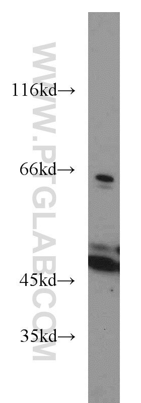 Western Blot (WB) analysis of HepG2 cells using ACADM Polyclonal antibody (55210-1-AP)