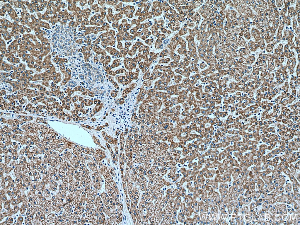 Immunohistochemistry (IHC) staining of human liver tissue using ACADM Monoclonal antibody (67742-1-Ig)