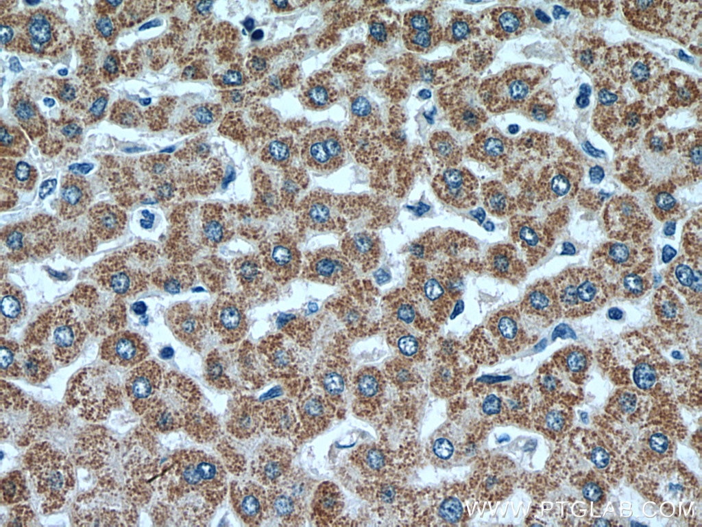 Immunohistochemistry (IHC) staining of human liver tissue using ACADM Monoclonal antibody (67742-1-Ig)