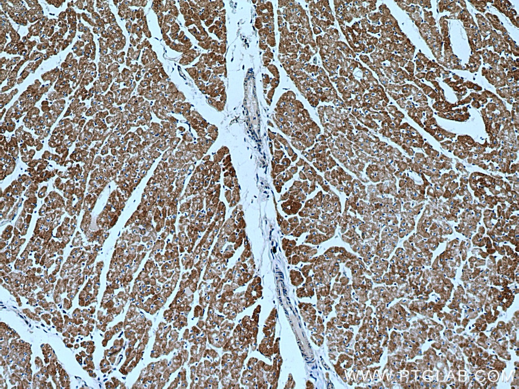 Immunohistochemistry (IHC) staining of human heart tissue using ACADM Monoclonal antibody (67742-1-Ig)