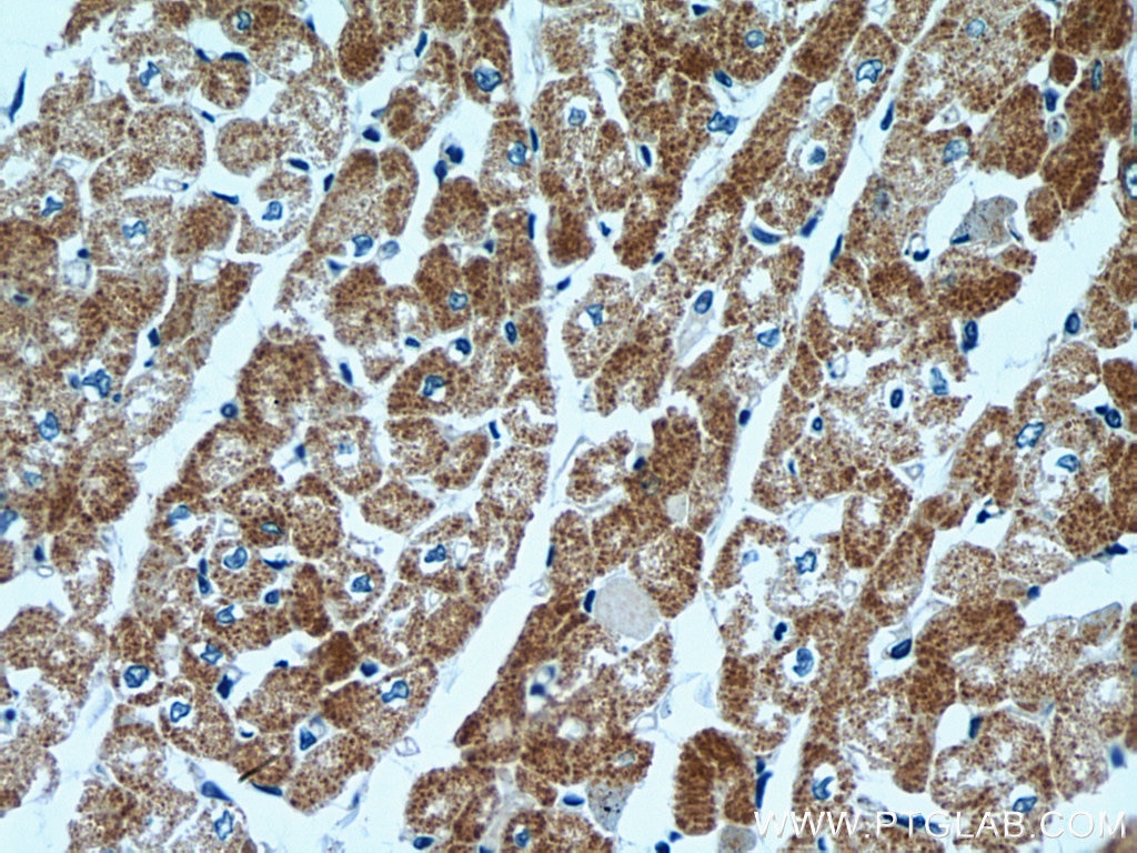Immunohistochemistry (IHC) staining of human heart tissue using ACADM Monoclonal antibody (67742-1-Ig)