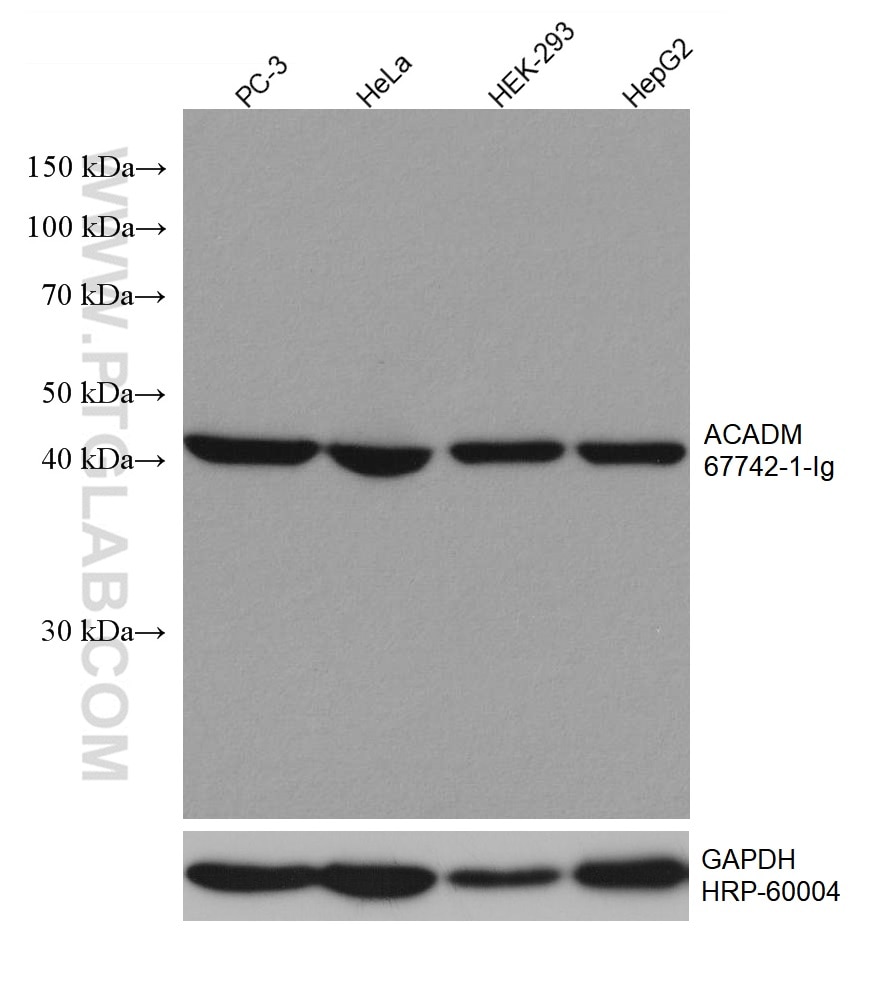 Western Blot (WB) analysis of various lysates using ACADM Monoclonal antibody (67742-1-Ig)