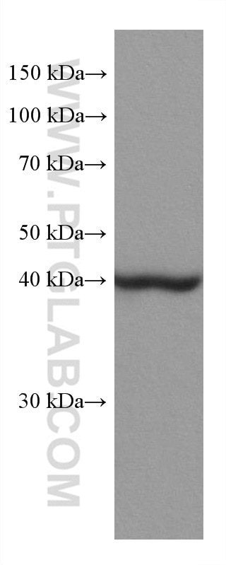 Western Blot (WB) analysis of rat liver tissue using ACADM Monoclonal antibody (67742-1-Ig)