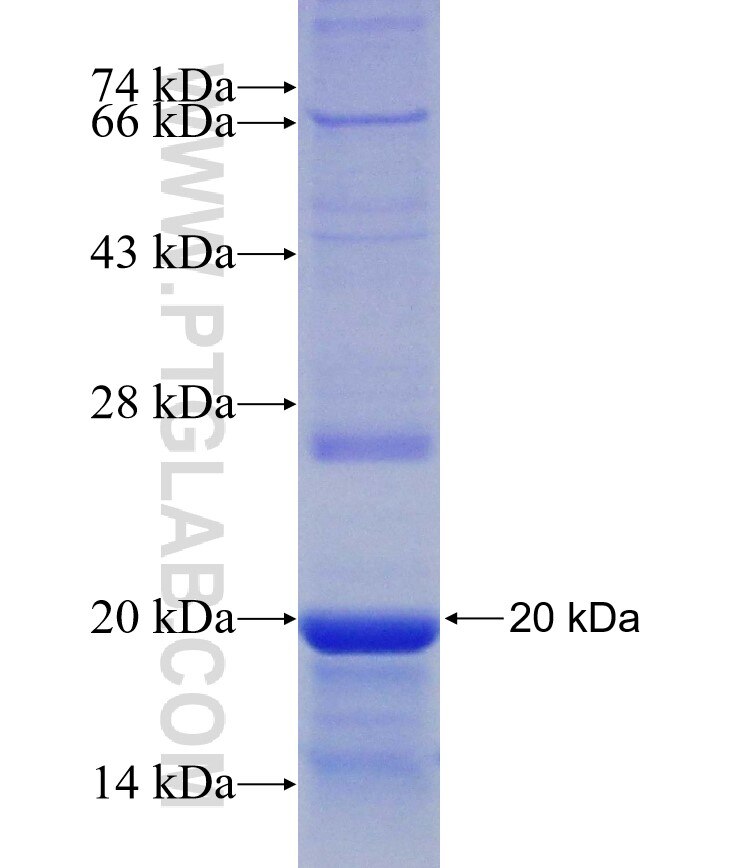 ACADM fusion protein Ag30620 SDS-PAGE