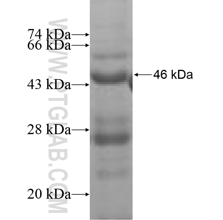 ACADM fusion protein Ag8682 SDS-PAGE