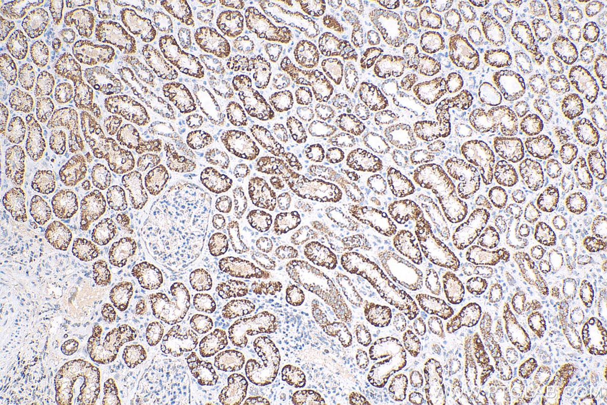 Immunohistochemistry (IHC) staining of human kidney tissue using ACADS Polyclonal antibody (16623-1-AP)