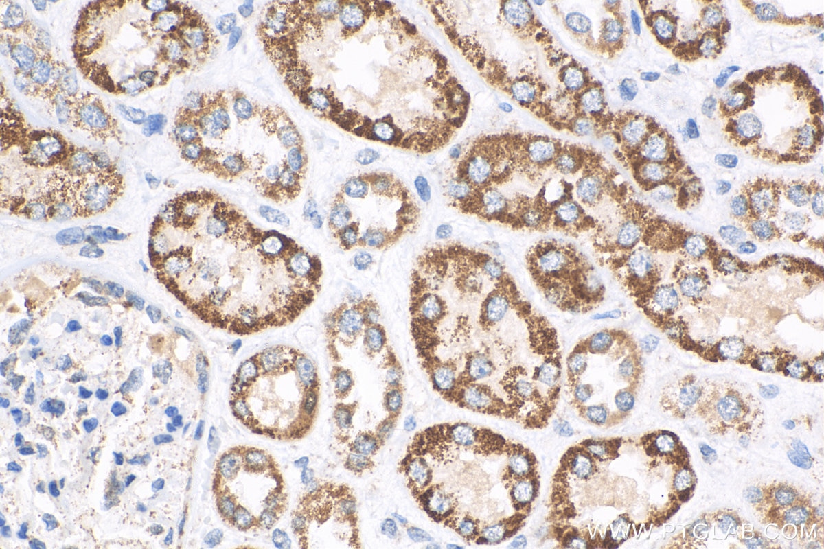 Immunohistochemistry (IHC) staining of human kidney tissue using ACADS Polyclonal antibody (16623-1-AP)