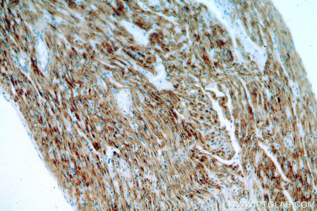 Immunohistochemistry (IHC) staining of human heart tissue using ACADS Polyclonal antibody (16623-1-AP)