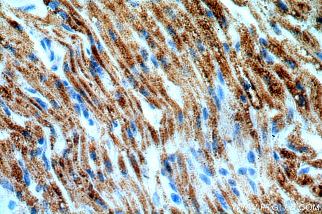 Immunohistochemistry (IHC) staining of human heart tissue using ACADS Polyclonal antibody (16623-1-AP)