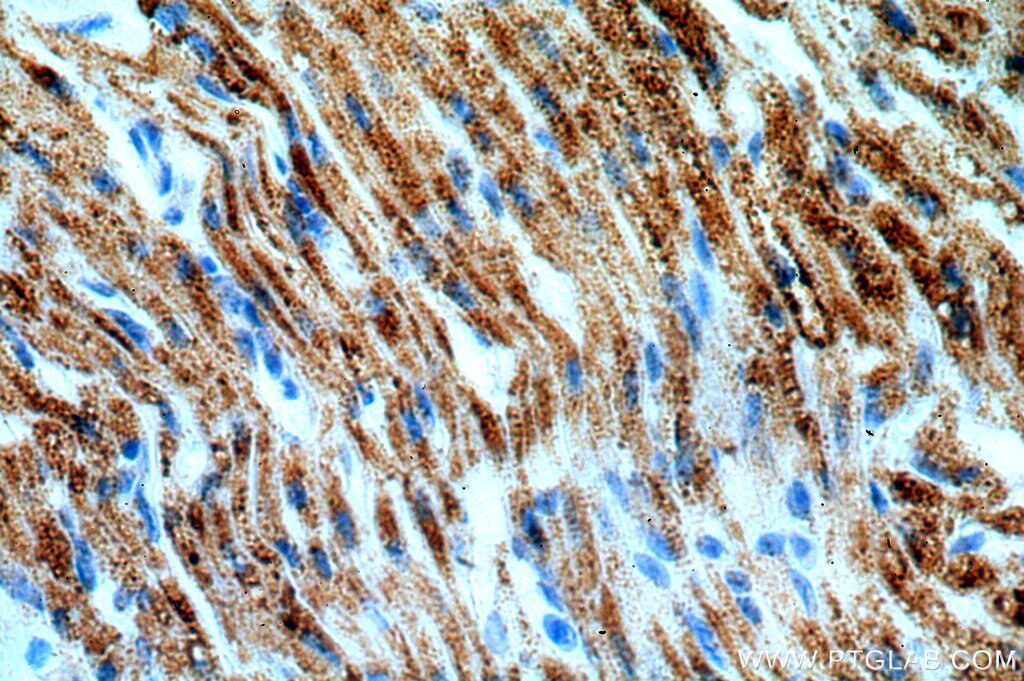 IHC staining of human heart using 16623-1-AP