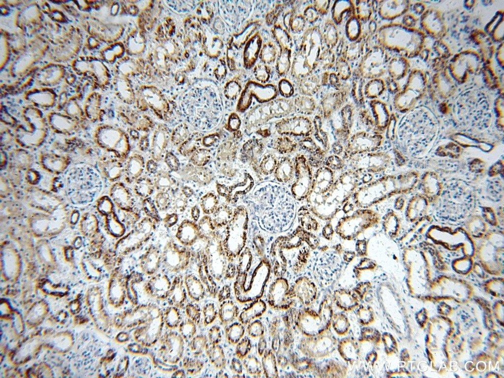 IHC staining of human kidney using 16623-1-AP